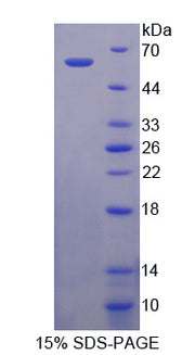 Figure 1. SDS-PAGE