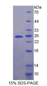 Figure 1. SDS-PAGE