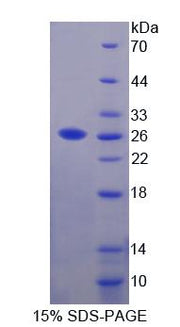 Figure 1. SDS-PAGE