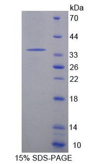 Figure 1. SDS-PAGE
