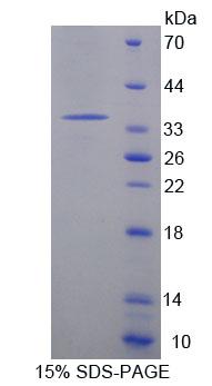 Figure 1. SDS-PAGE
