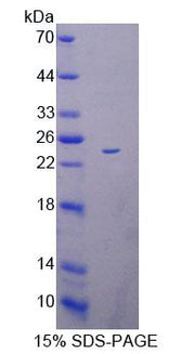 Figure 1. SDS-PAGE