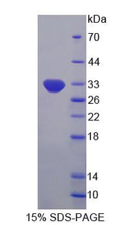 Figure 1. SDS-PAGE