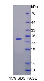 Figure 1. SDS-PAGE