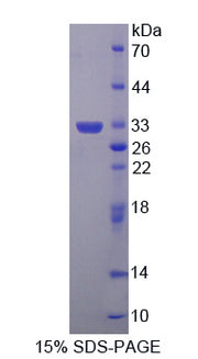 Figure 1. SDS-PAGE