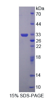 Figure 1. SDS-PAGE