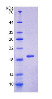 Figure 1. SDS-PAGE