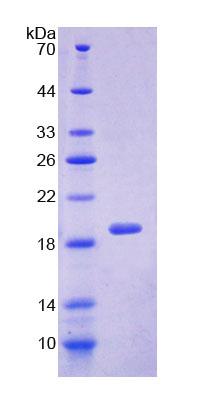 Figure 1. SDS-PAGE