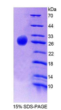 Figure 1. SDS-PAGE