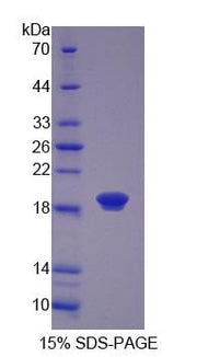 Figure 1. SDS-PAGE