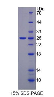 Figure 1. SDS-PAGE