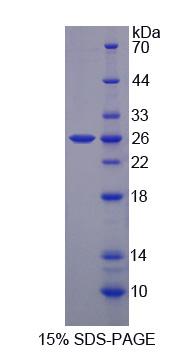Figure 1. SDS-PAGE