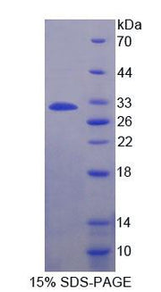 Figure 1. SDS-PAGE