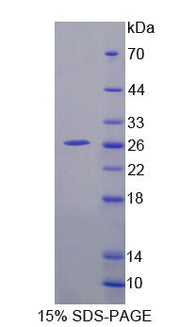Figure 1. SDS-PAGE