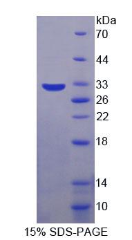 Figure 1. SDS-PAGE