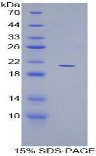 Figure 1. SDS-PAGE