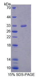 Figure 1. SDS-PAGE