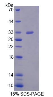 Figure 1. SDS-PAGE