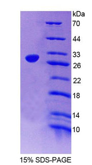 Figure 1. SDS-PAGE
