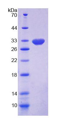 Figure 1. SDS-PAGE