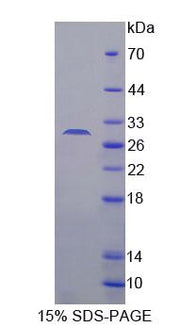 Figure 1. SDS-PAGE