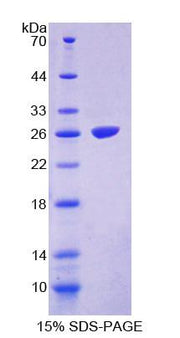 Figure 1. SDS-PAGE