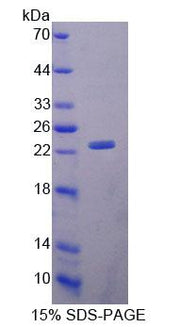 Figure 1. SDS-PAGE