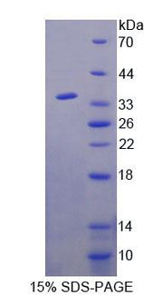 Figure 1. SDS-PAGE