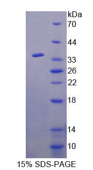 Figure 1. SDS-PAGE