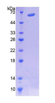 Figure 1. SDS-PAGE