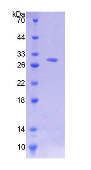 Figure 1. SDS-PAGE