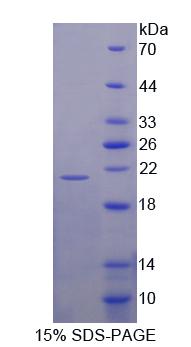 Figure 1. SDS-PAGE