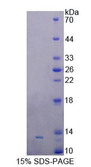 Figure 1. SDS-PAGE