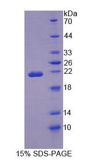 Figure 1. SDS-PAGE