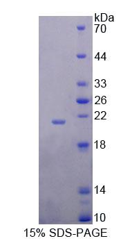Figure 1. SDS-PAGE
