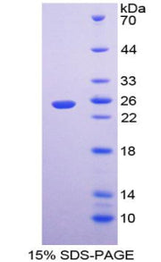 Figure 1. SDS-PAGE