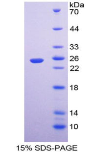 Figure 1. SDS-PAGE