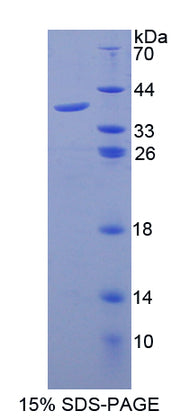 Figure 1. SDS-PAGE