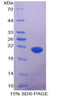 Figure 1. SDS-PAGE