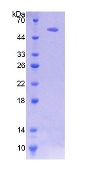 Figure 1. SDS-PAGE
