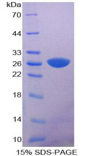 Figure 1. SDS-PAGE
