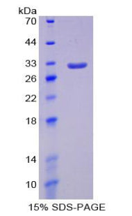 Figure 1. SDS-PAGE