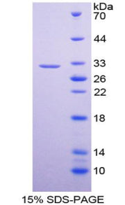 Figure 1. SDS-PAGE