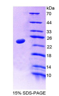 Figure 1. SDS-PAGE