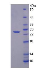 Figure 2. SDS-PAGE