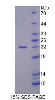 Figure 1. SDS-PAGE