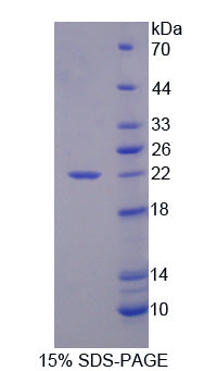 Figure 1. SDS-PAGE