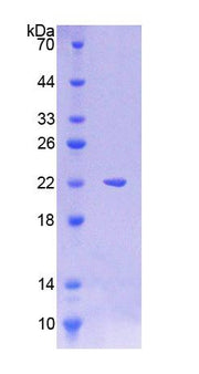 Figure 1. SDS-PAGE