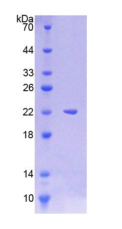 Figure 1. SDS-PAGE