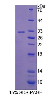 Figure 1. SDS-PAGE